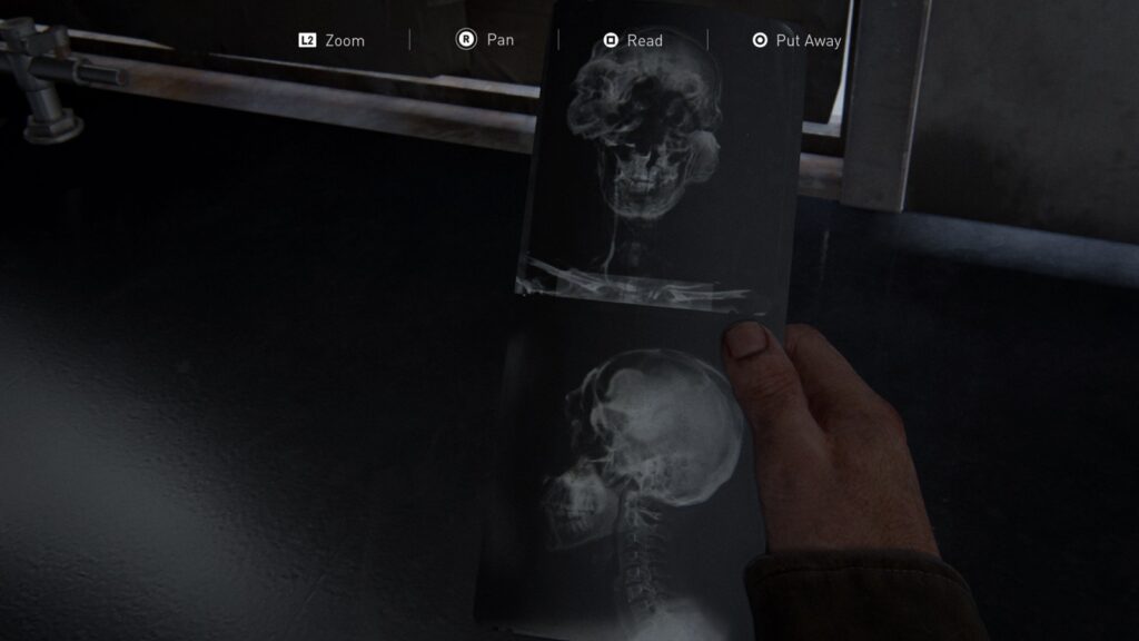 Fungal X-Rays - Last of Us Part 1 The University Collectible